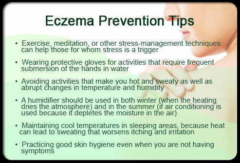 tips to alleviate eczema