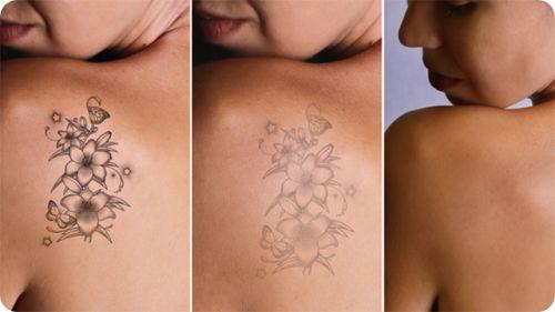 natural oils that fade tattoos